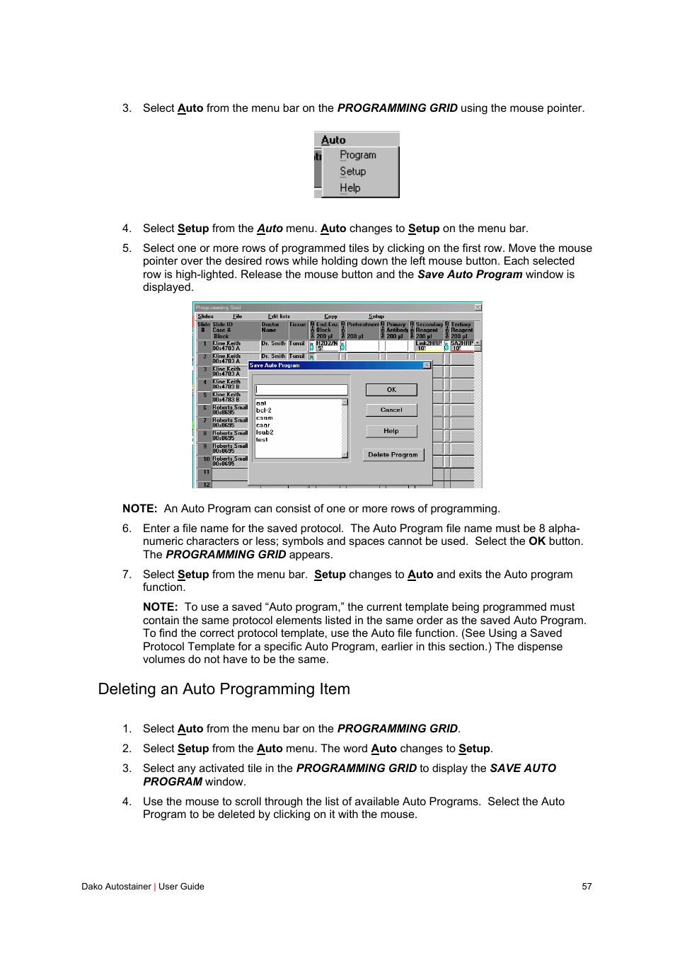 Deleting an auto programming item | Dako Autostainer User Manual | Page 57 / 125