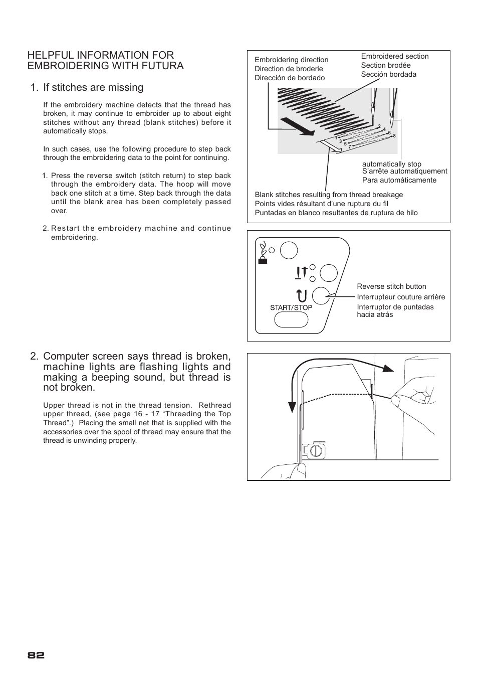 If stitches are missing | SINGER XL-400 FUTURA Instruction Manual User Manual | Page 84 / 112