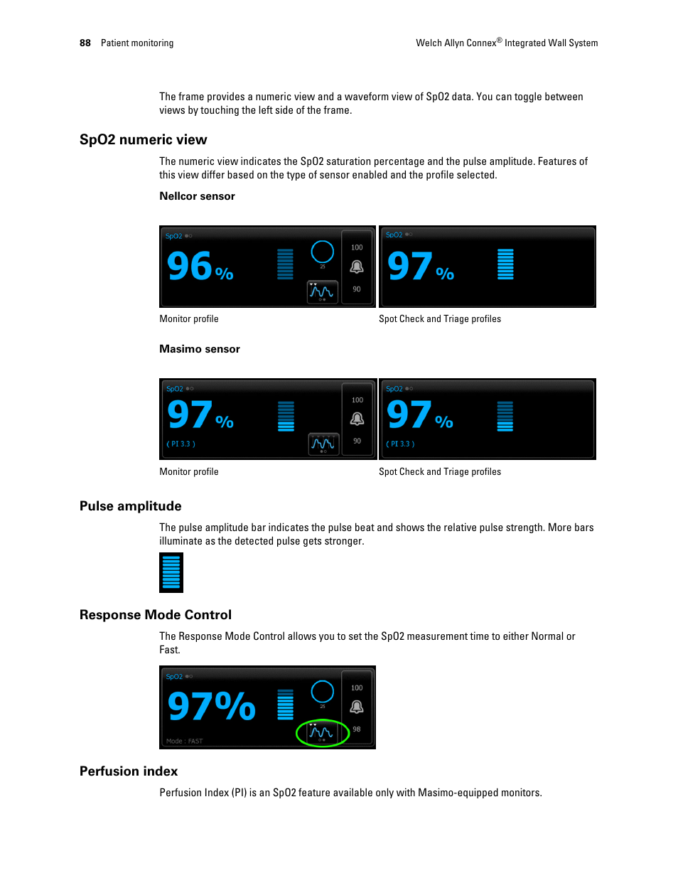 Spo2 numeric view | Welch Allyn Connex Integrated Wall System - User Manual User Manual | Page 94 / 161