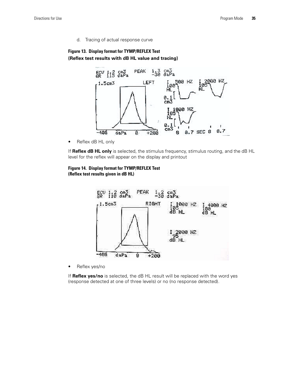 Welch Allyn TM286 Auto Tymp - User Manual User Manual | Page 39 / 72