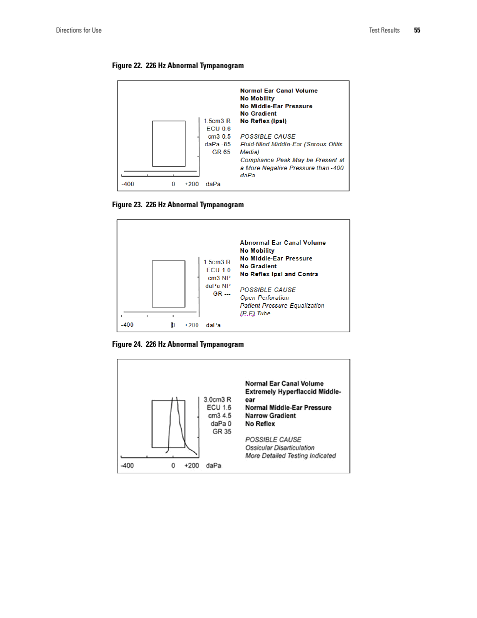 Welch Allyn TM286 Auto Tymp - User Manual User Manual | Page 59 / 72