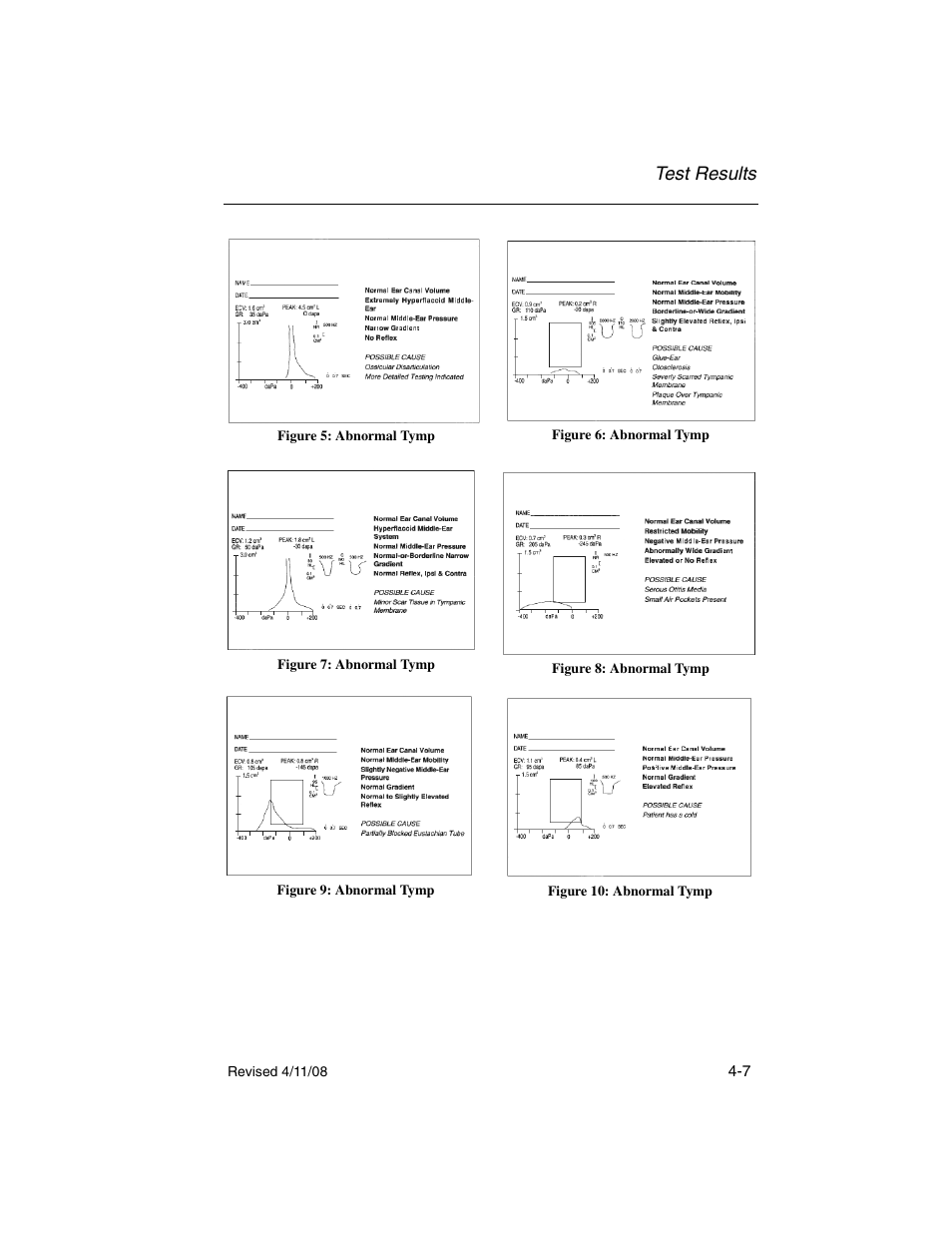 Test results | Welch Allyn TM 262 Auto Tymp - User Manual User Manual | Page 65 / 92