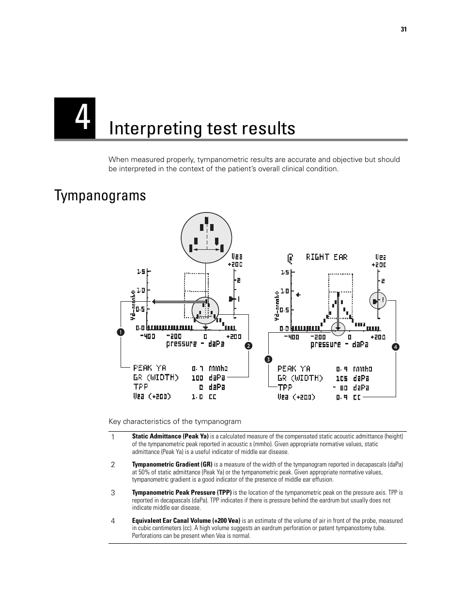 Interpreting test results, Tympanograms, 4 - interpreting test results | Welch Allyn MicroTymp 3 portable tympanometric instrument - User Manual User Manual | Page 31 / 76