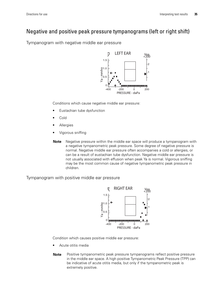Left ear, Right ear, Tympanogram with negative middle ear pressure | Tympanogram with positive middle ear pressure | Welch Allyn MicroTymp 3 portable tympanometric instrument - User Manual User Manual | Page 35 / 76