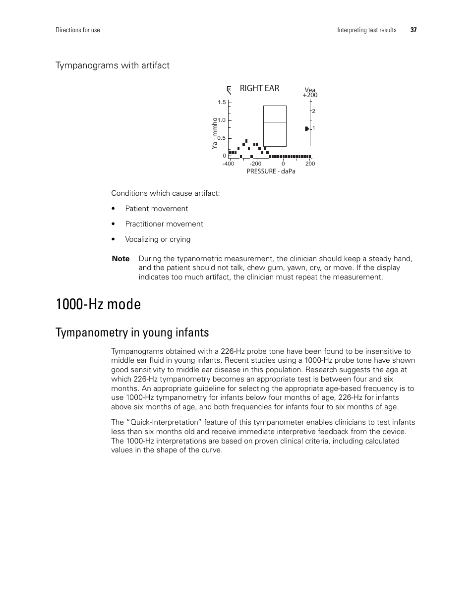 1000-hz mode, Tympanometry in young infants, Right ear | Tympanograms with artifact | Welch Allyn MicroTymp 3 portable tympanometric instrument - User Manual User Manual | Page 37 / 76