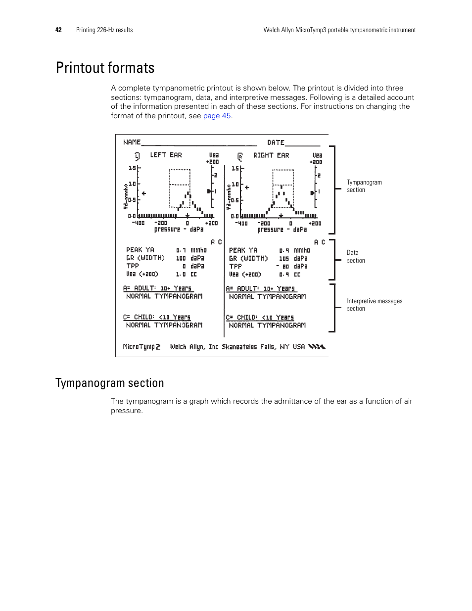 Printout formats, Tympanogram section | Welch Allyn MicroTymp 3 portable tympanometric instrument - User Manual User Manual | Page 42 / 76