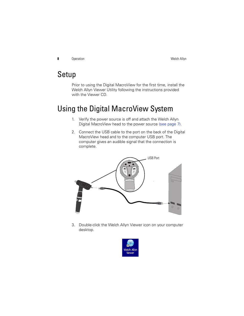 Setup, Using the digital macroview system, Setup using the digital macroview system | Welch Allyn Digital MacroView Otoscope - User Manual User Manual | Page 14 / 32