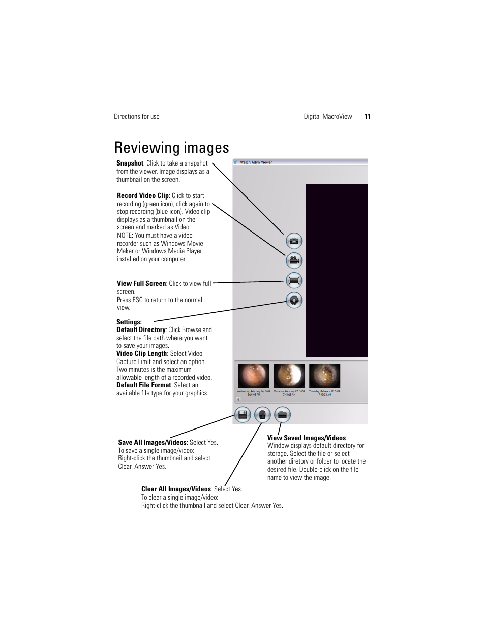 Reviewing images | Welch Allyn Digital MacroView Otoscope - User Manual User Manual | Page 17 / 32