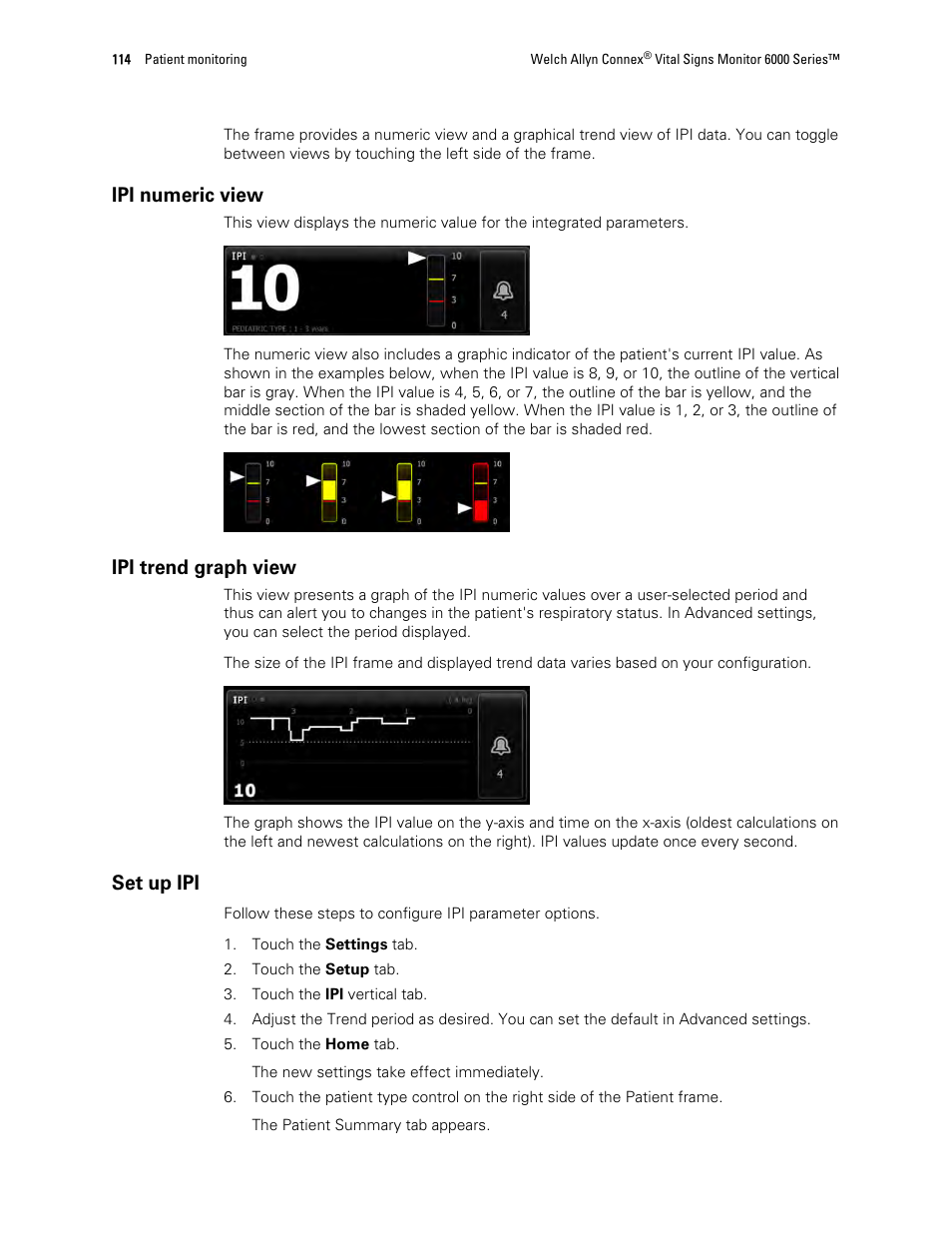 Ipi numeric view, Ipi trend graph view, Set up ipi | Welch Allyn 6000 Series Connex Vital Signs Monitor - User Manual User Manual | Page 120 / 245