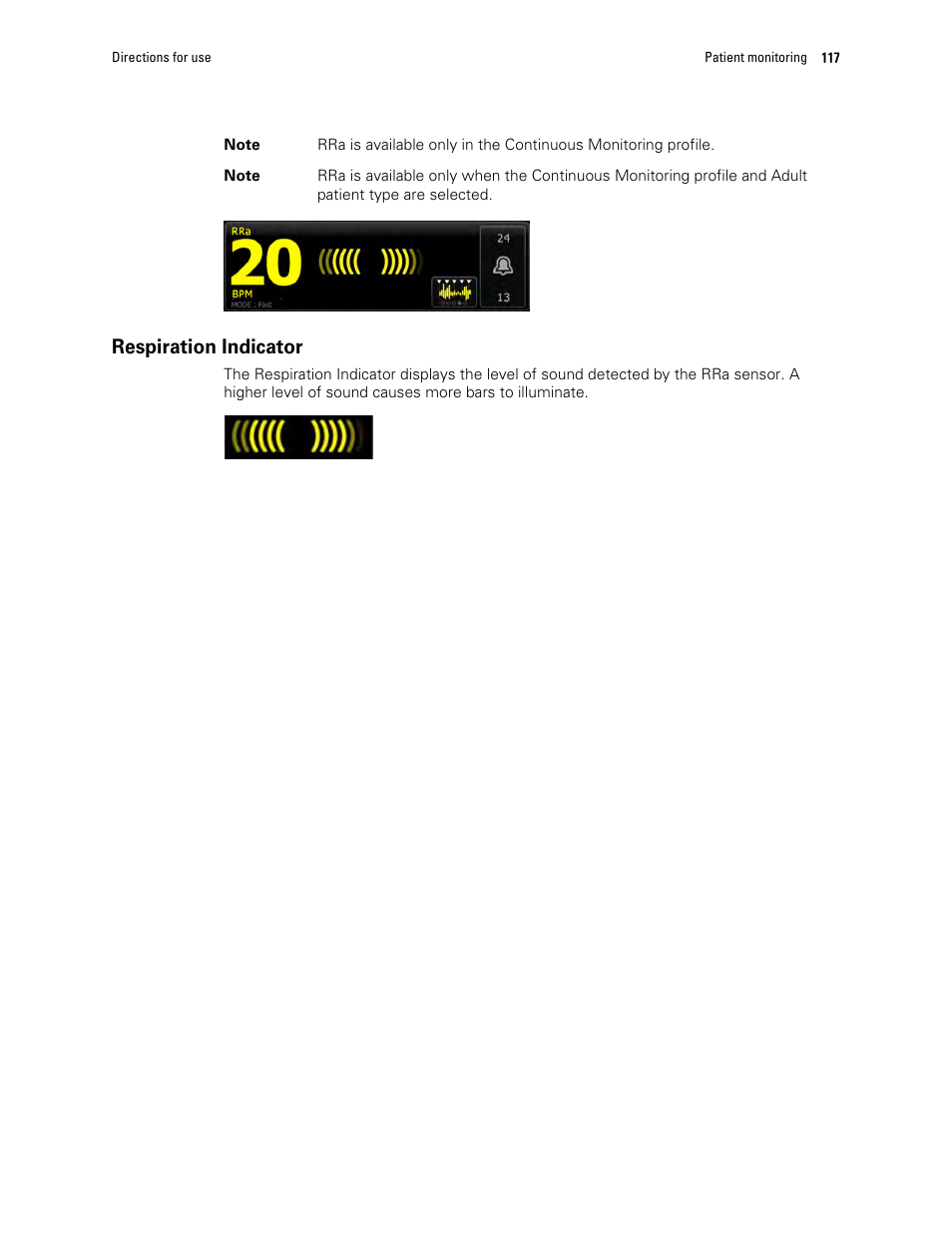 Respiration indicator | Welch Allyn 6000 Series Connex Vital Signs Monitor - User Manual User Manual | Page 123 / 245