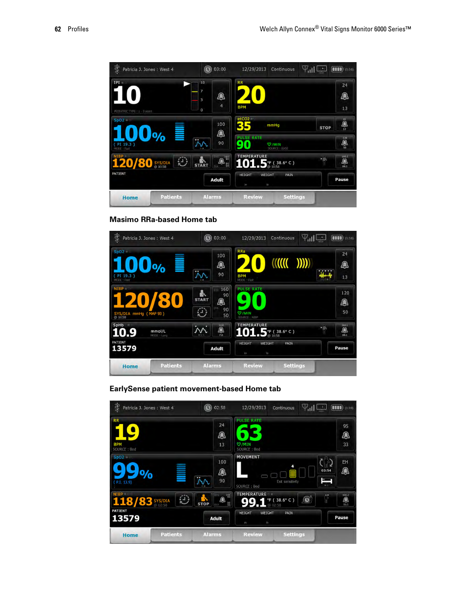 Welch Allyn 6000 Series Connex Vital Signs Monitor - User Manual User Manual | Page 68 / 245