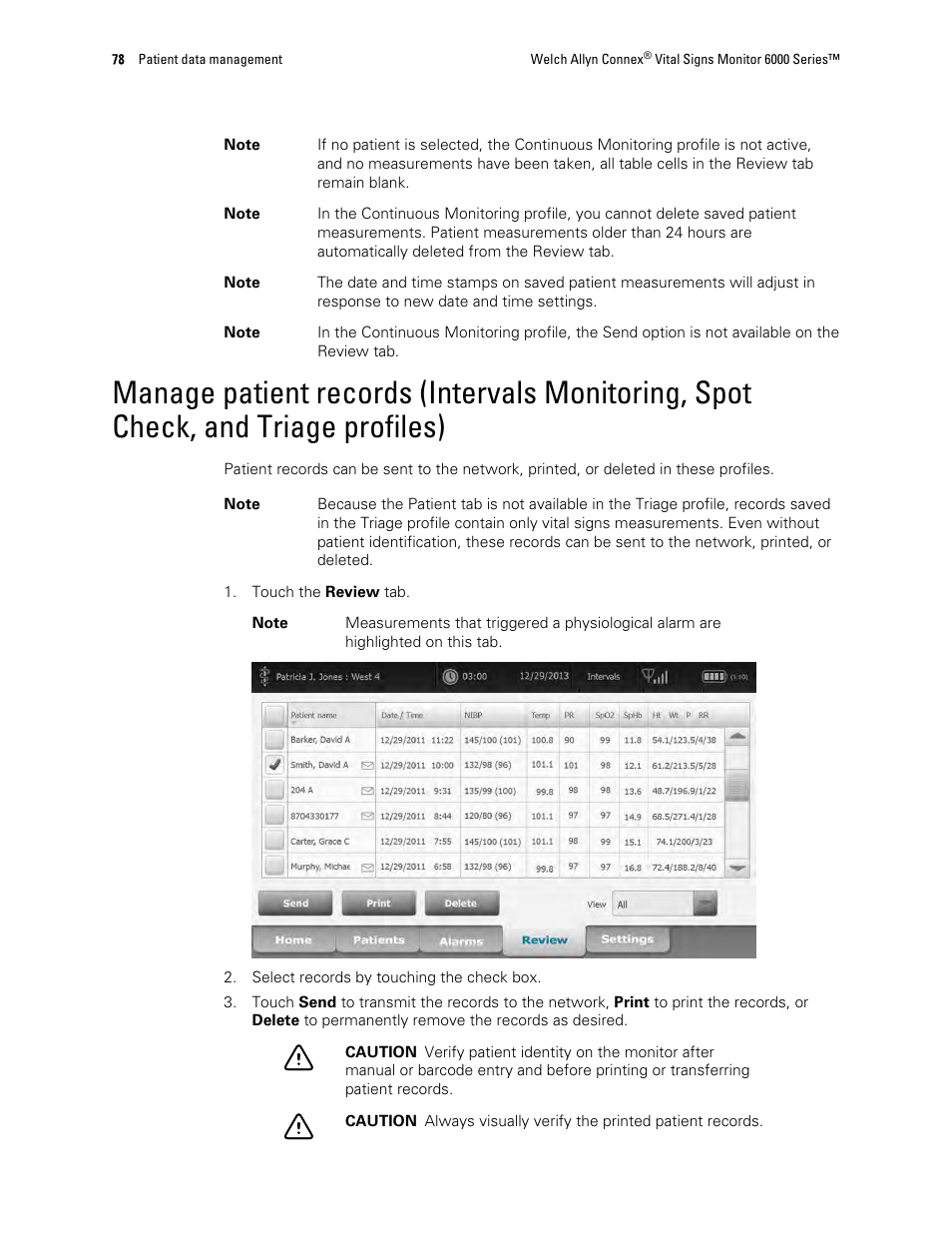 Welch Allyn 6000 Series Connex Vital Signs Monitor - User Manual User Manual | Page 84 / 245