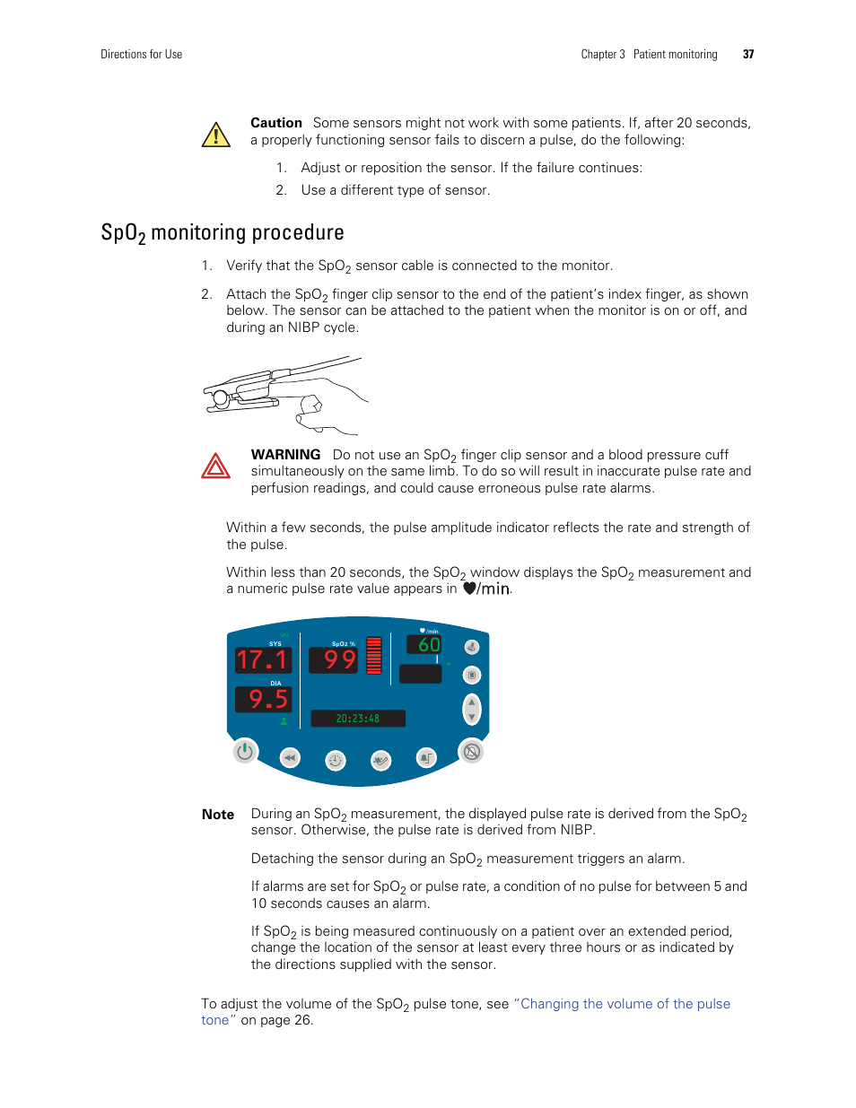 Monitoring procedure | Welch Allyn 300 Series Vital Signs Monitor - User Manual User Manual | Page 41 / 86