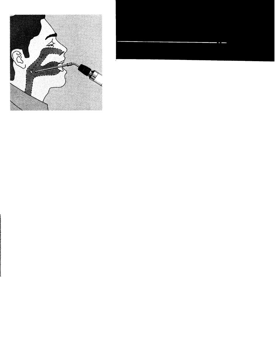 Welch Allyn Illuminators and Transilluminators - User Manual User Manual | Page 10 / 12