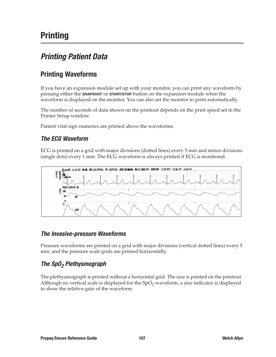 Printing, Printing patient data, Printing waveforms | The ecg waveform, The invasive-pressure waveforms, The spo2 plethysmograph | Welch Allyn 20хEL Propaq Encore Vital Signs Monitor - Reference Guide User Manual | Page 107 / 178