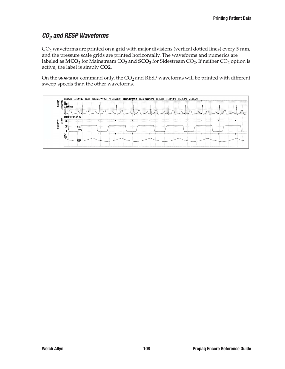 Co2 and resp waveforms, And resp waveforms | Welch Allyn 20хEL Propaq Encore Vital Signs Monitor - Reference Guide User Manual | Page 108 / 178