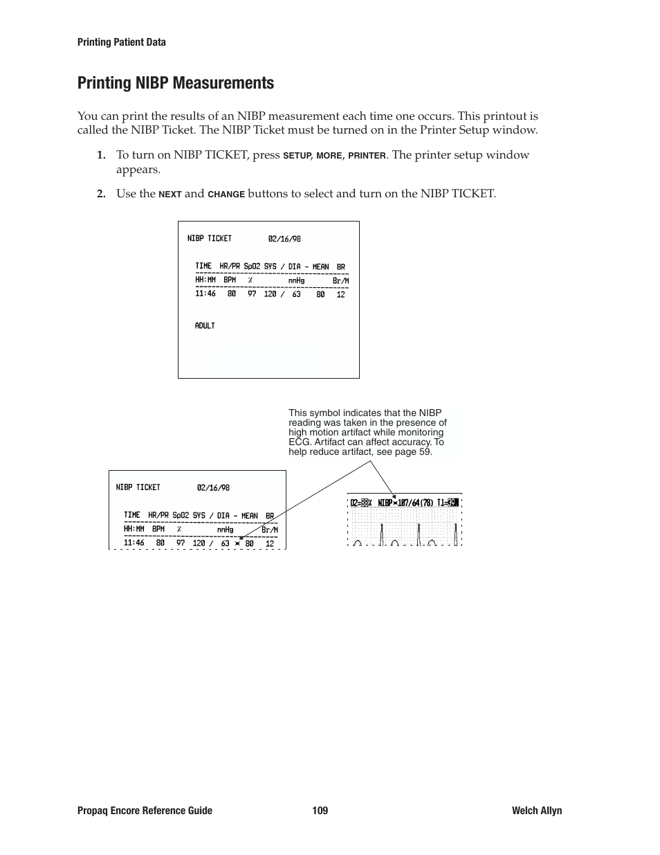 Printing nibp measurements | Welch Allyn 20хEL Propaq Encore Vital Signs Monitor - Reference Guide User Manual | Page 109 / 178