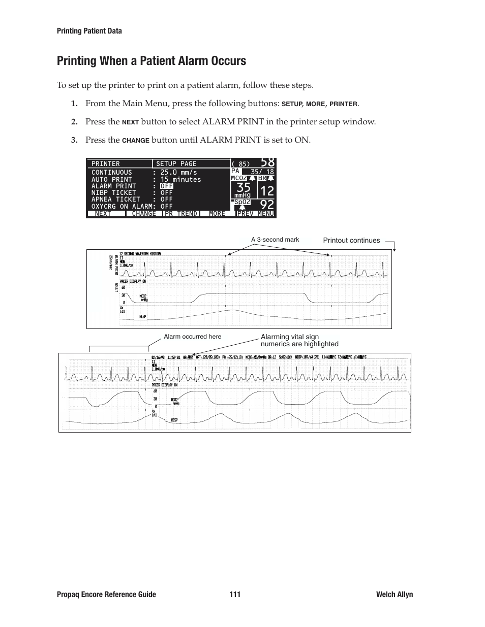 Printing when a patient alarm occurs | Welch Allyn 20хEL Propaq Encore Vital Signs Monitor - Reference Guide User Manual | Page 111 / 178