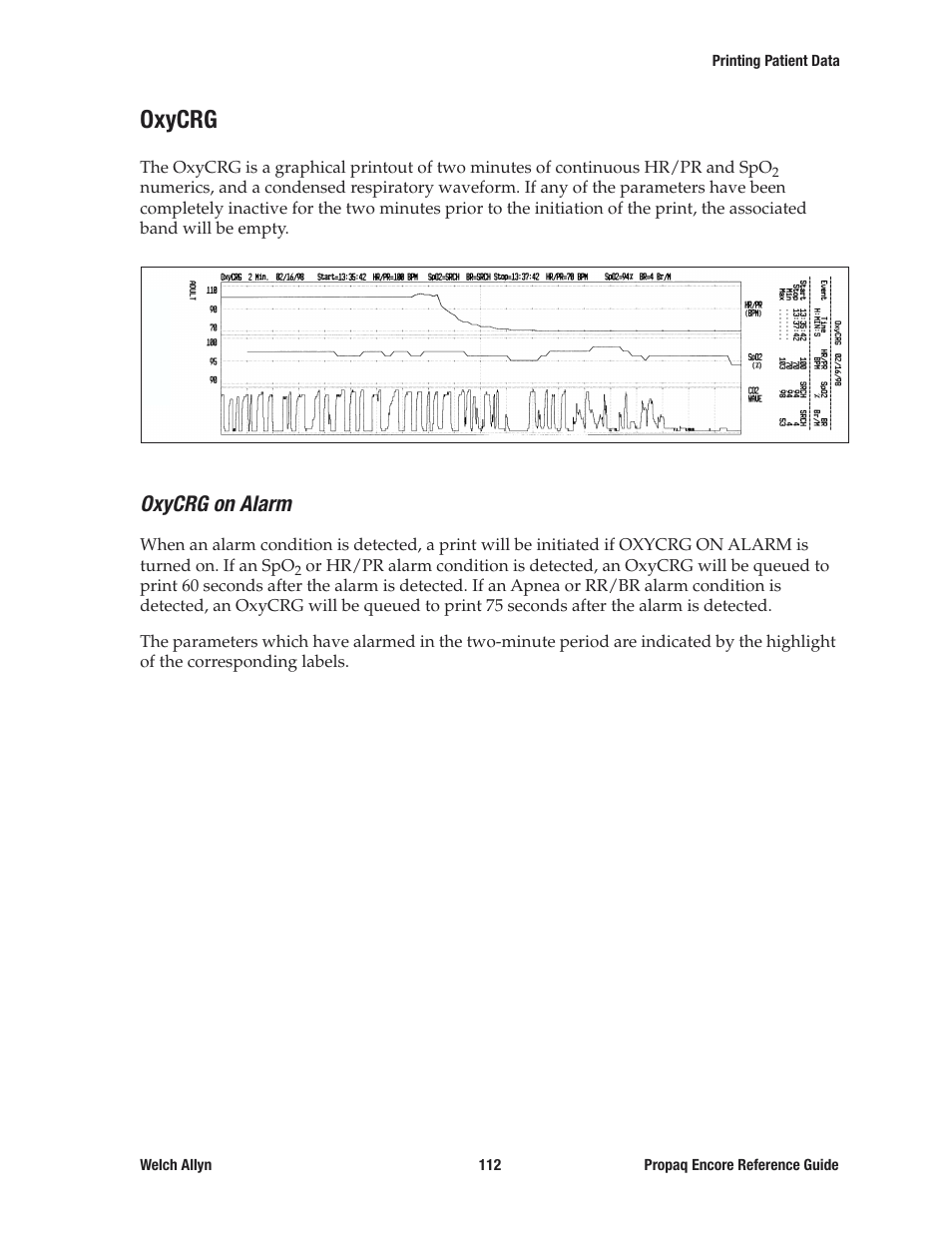 Oxycrg, Oxycrg on alarm | Welch Allyn 20хEL Propaq Encore Vital Signs Monitor - Reference Guide User Manual | Page 112 / 178