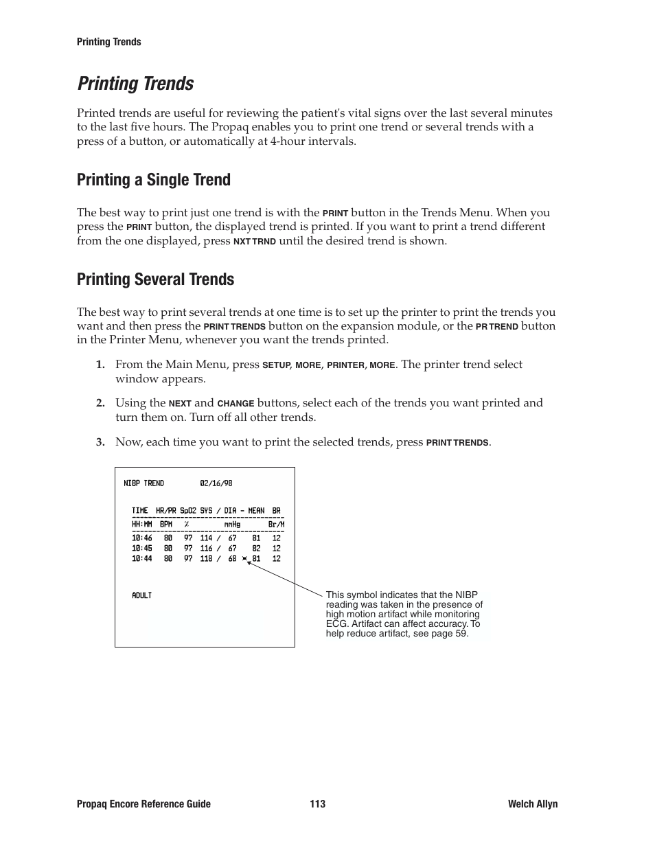 Printing trends, Printing a single trend, Printing several trends | Printing a single trend printing several trends | Welch Allyn 20хEL Propaq Encore Vital Signs Monitor - Reference Guide User Manual | Page 113 / 178