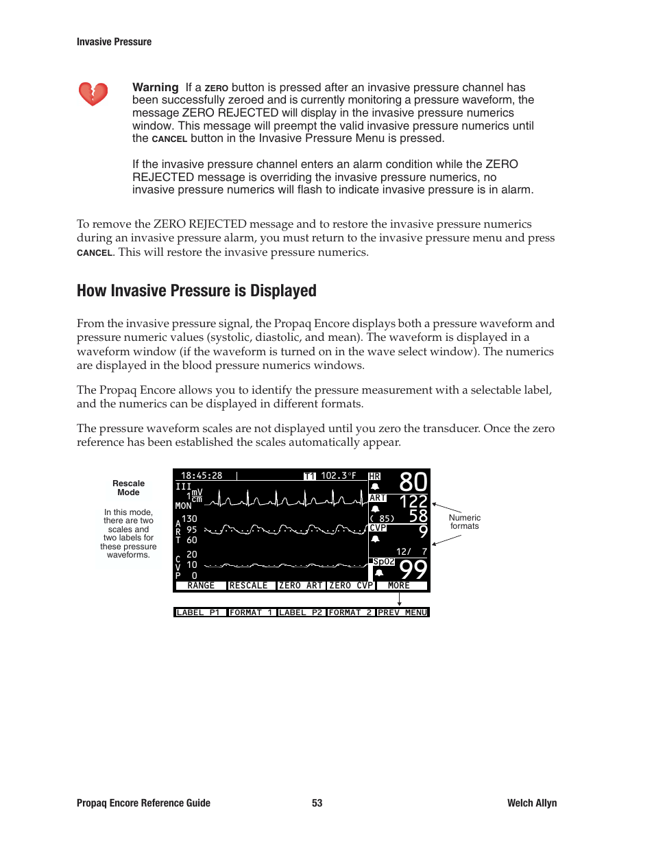 How invasive pressure is displayed | Welch Allyn 20хEL Propaq Encore Vital Signs Monitor - Reference Guide User Manual | Page 53 / 178