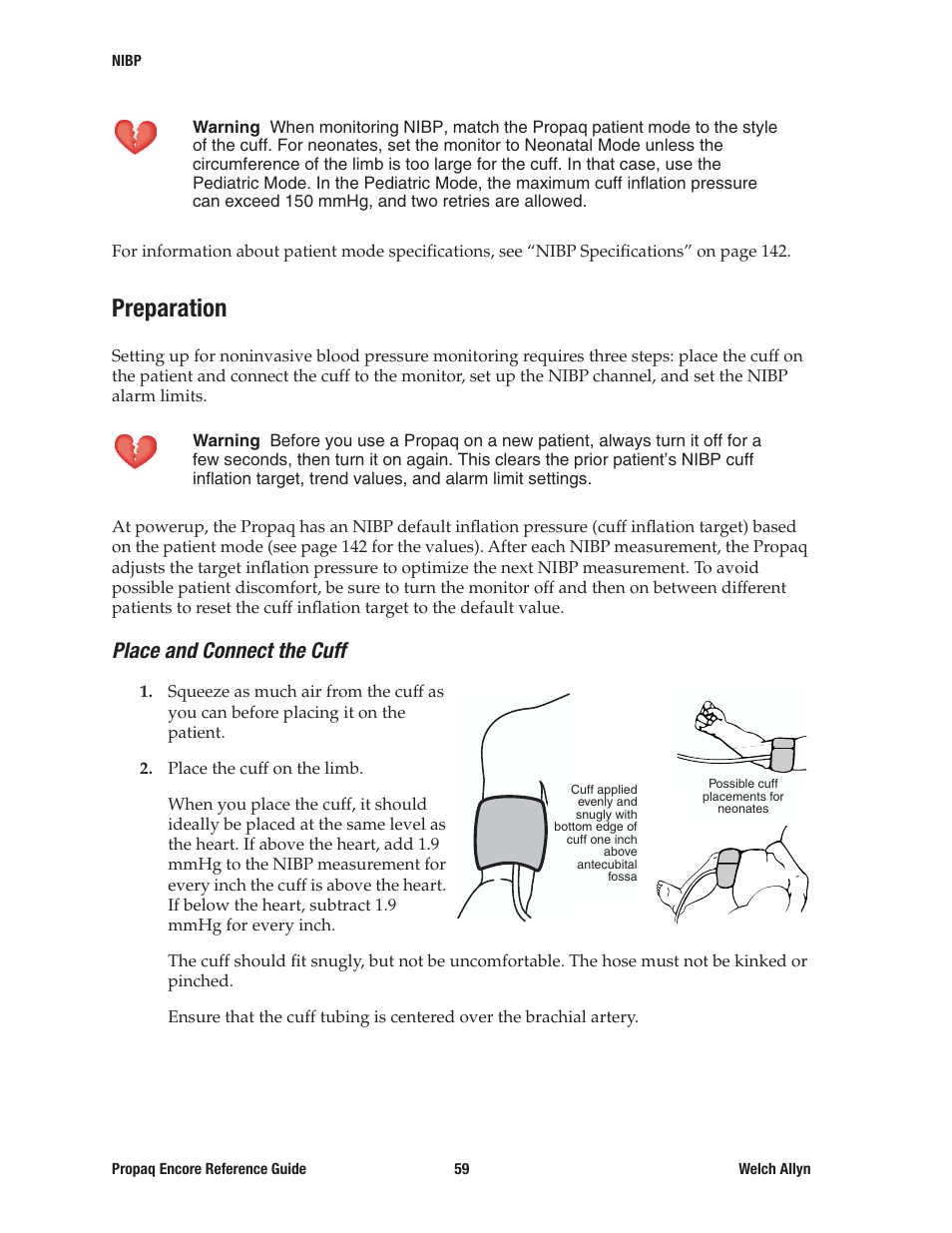 Preparation, Place and connect the cuff | Welch Allyn 20хEL Propaq Encore Vital Signs Monitor - Reference Guide User Manual | Page 59 / 178