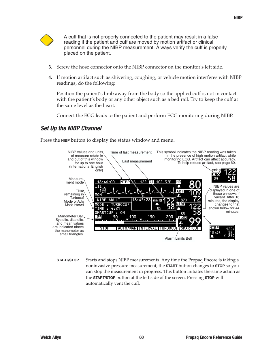 Set up the nibp channel | Welch Allyn 20хEL Propaq Encore Vital Signs Monitor - Reference Guide User Manual | Page 60 / 178