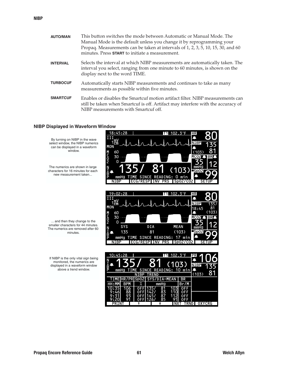 Welch Allyn 20хEL Propaq Encore Vital Signs Monitor - Reference Guide User Manual | Page 61 / 178