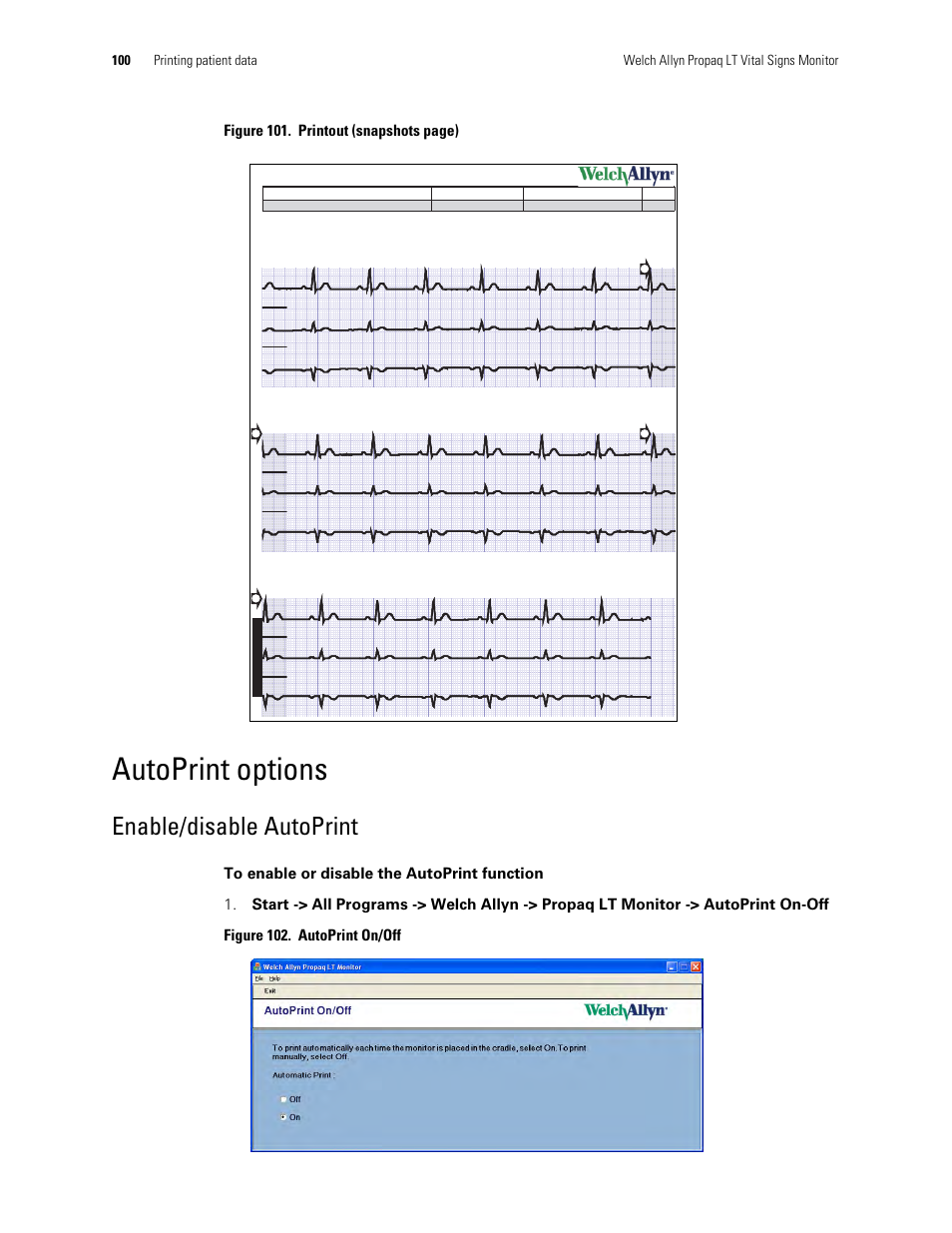 Autoprint options, Enable/disable autoprint, Figure 101. printout (snapshots page) | Welch Allyn 901061 Propaq LT Vital Signs Monitor - User Manual User Manual | Page 104 / 196