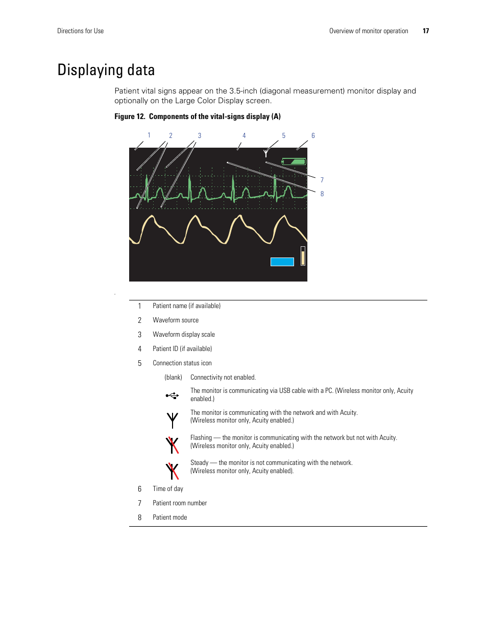 Displaying data | Welch Allyn 901061 Propaq LT Vital Signs Monitor - User Manual User Manual | Page 21 / 196
