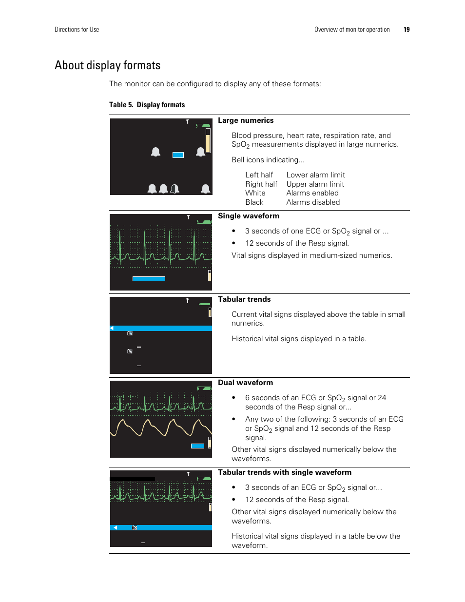 About display formats | Welch Allyn 901061 Propaq LT Vital Signs Monitor - User Manual User Manual | Page 23 / 196