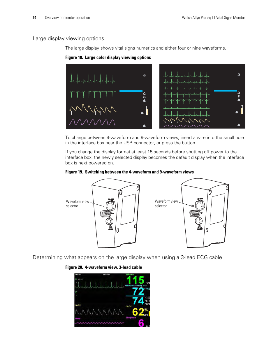 Large display viewing options, Figure 20. 4-waveform view, 3-lead cable | Welch Allyn 901061 Propaq LT Vital Signs Monitor - User Manual User Manual | Page 28 / 196