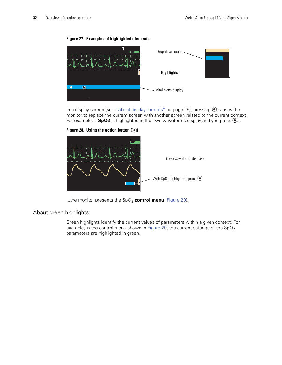 About green highlights, Control menu ( figure 29 ), Parameters are highlighted in green | Welch Allyn 901061 Propaq LT Vital Signs Monitor - User Manual User Manual | Page 36 / 196
