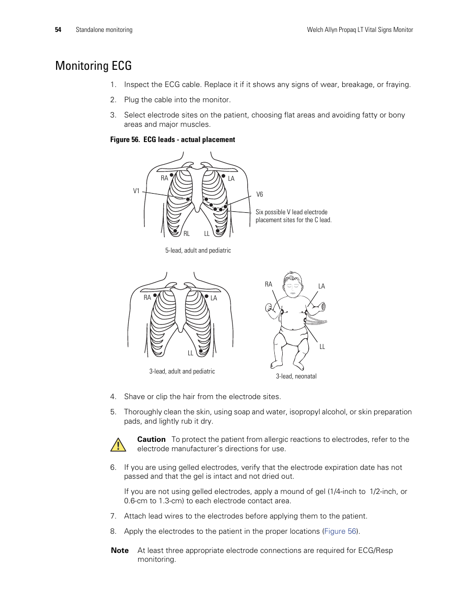 Monitoring ecg | Welch Allyn 901061 Propaq LT Vital Signs Monitor - User Manual User Manual | Page 58 / 196
