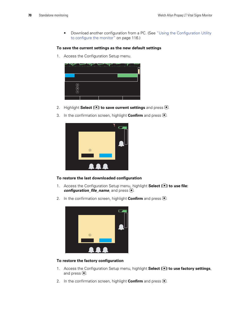 Welch Allyn 901061 Propaq LT Vital Signs Monitor - User Manual User Manual | Page 74 / 196