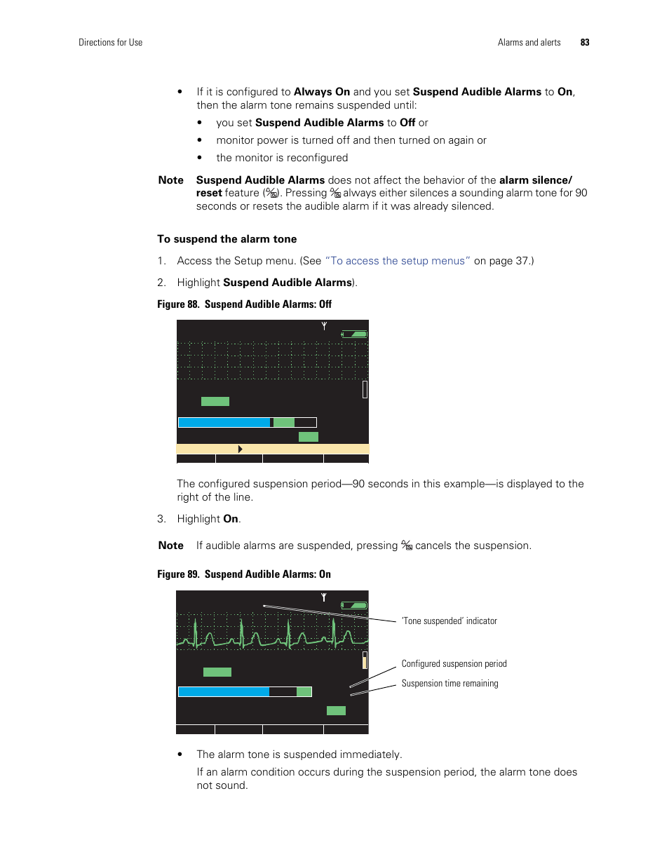 Welch Allyn 901061 Propaq LT Vital Signs Monitor - User Manual User Manual | Page 87 / 196