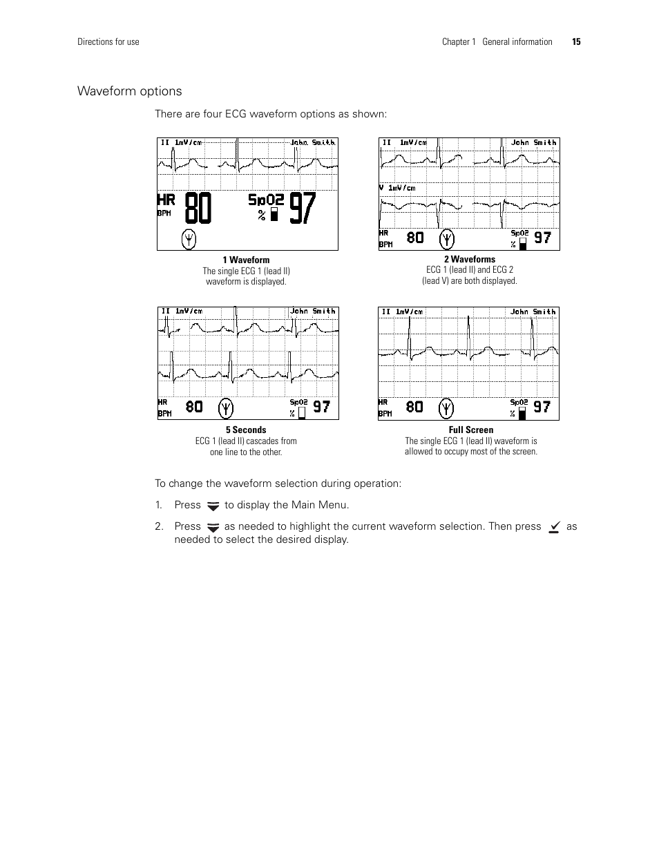 Waveform options | Welch Allyn 408 Micropaq Monitor - User Manual User Manual | Page 19 / 82