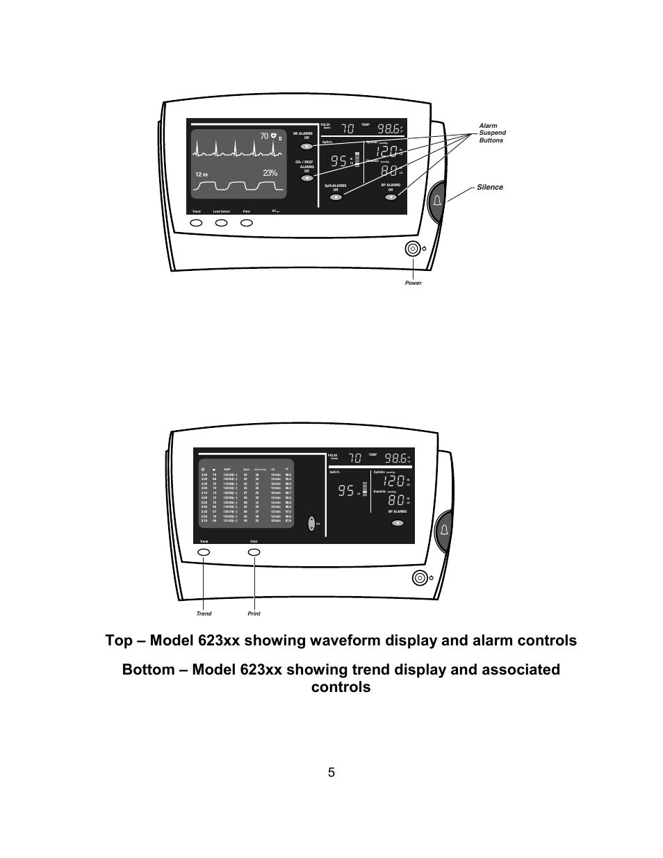 Silence, Alarm suspend buttons | Welch Allyn Atlas Monitor - User Manual User Manual | Page 17 / 108