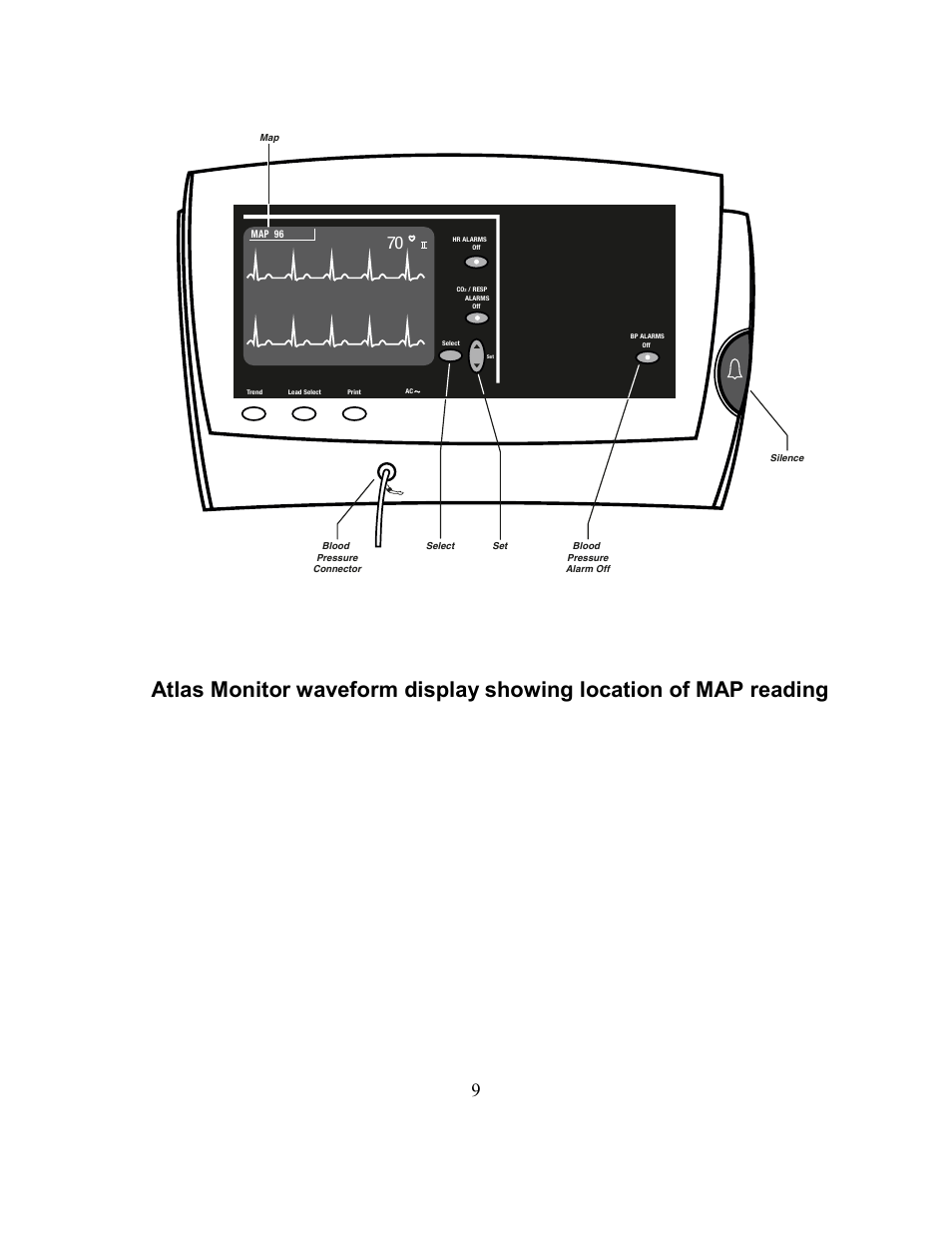 Welch Allyn Atlas Monitor - User Manual User Manual | Page 21 / 108