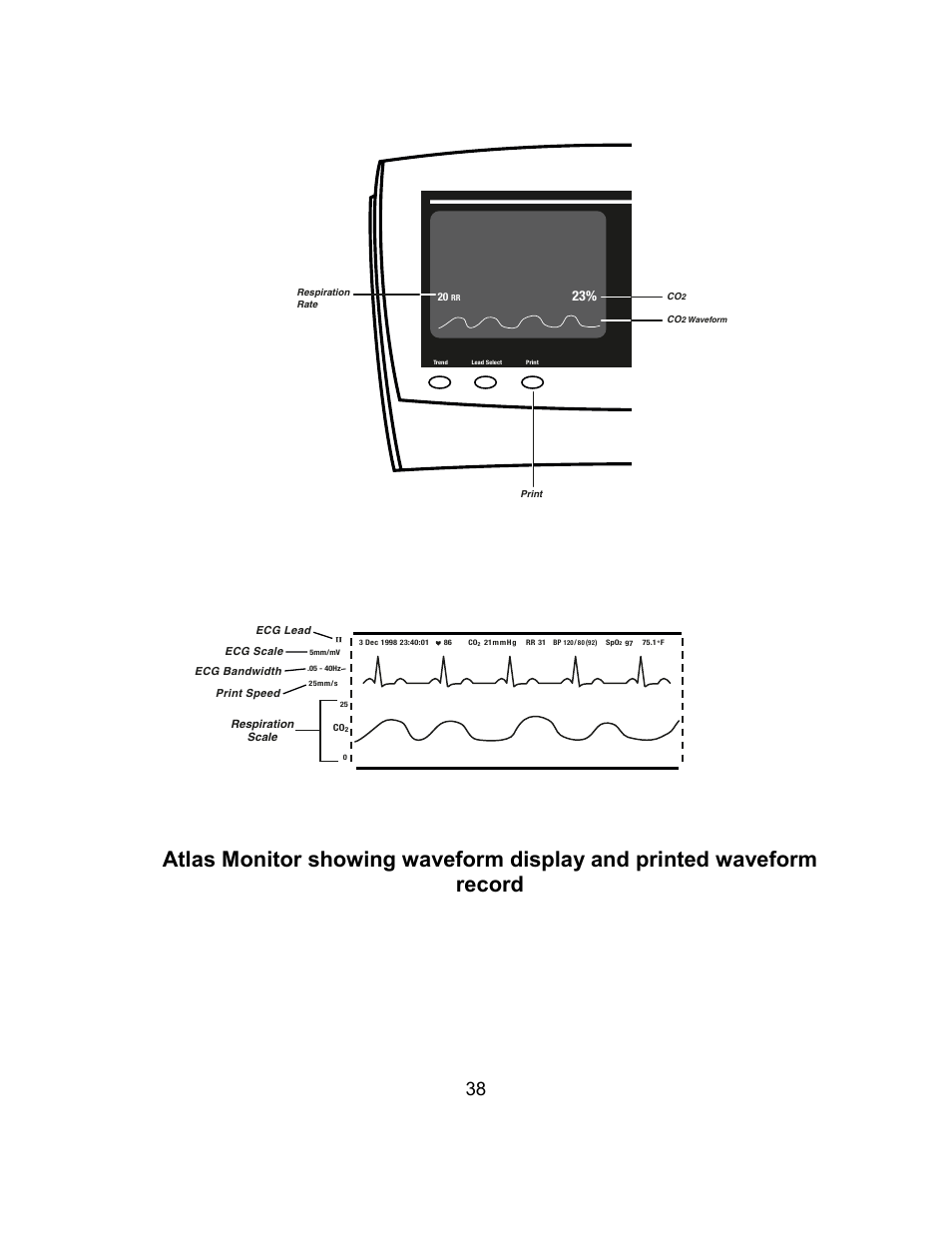 Welch Allyn Atlas Monitor - User Manual User Manual | Page 50 / 108