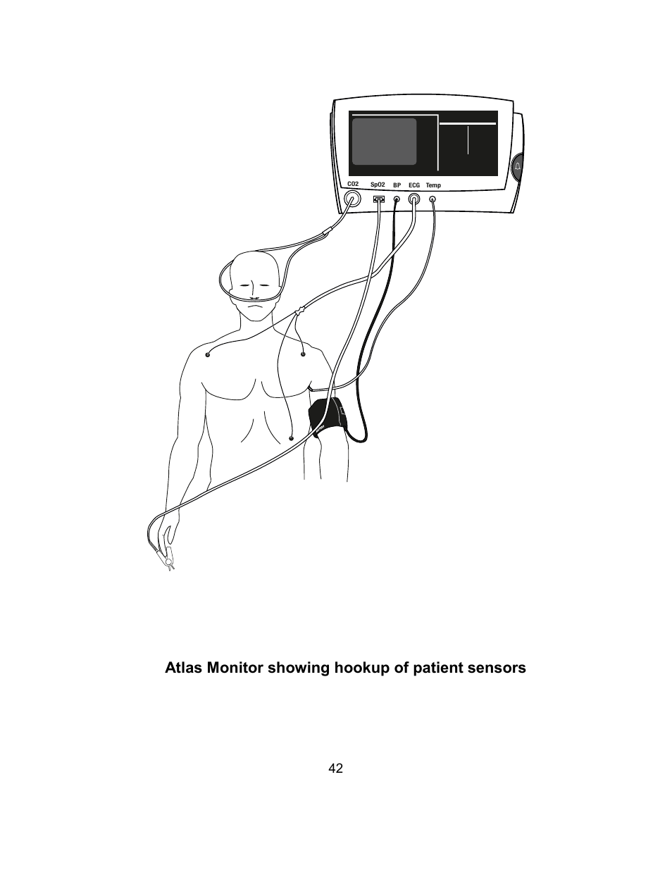 Atlas monitor showing hookup of patient sensors | Welch Allyn Atlas Monitor - User Manual User Manual | Page 54 / 108
