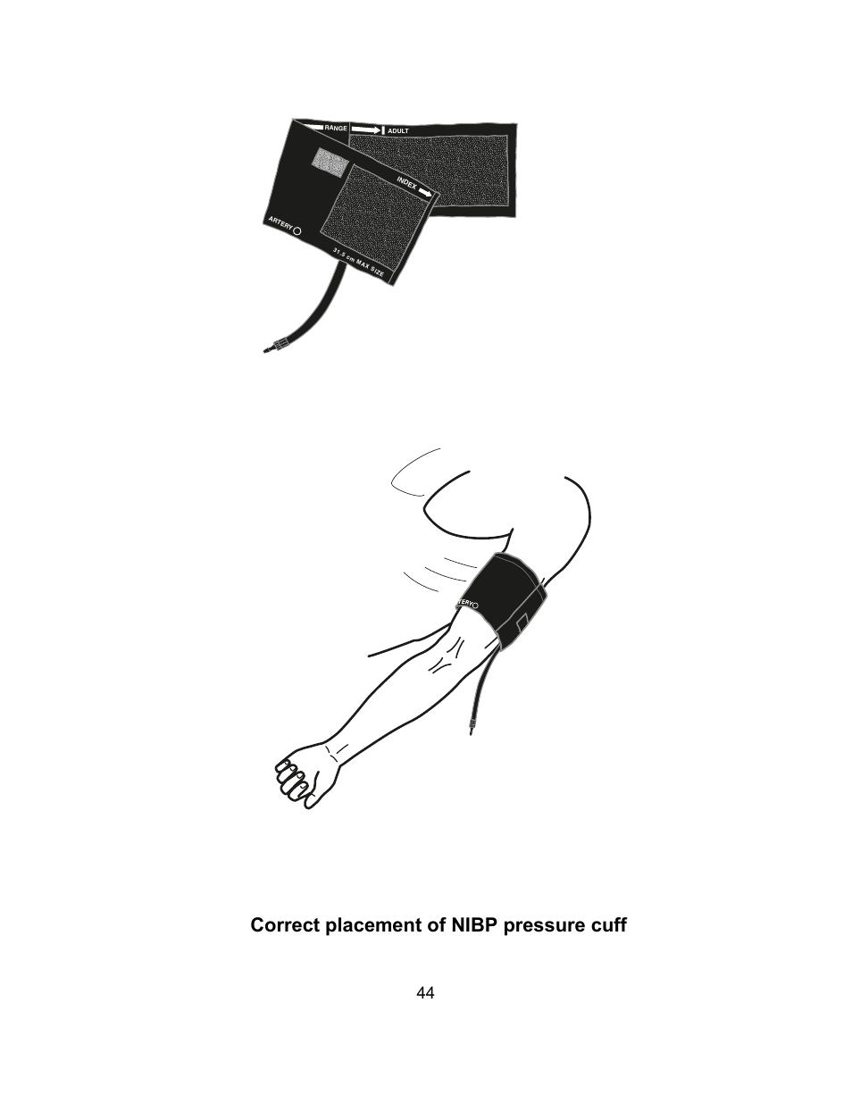 Correct placement of nibp pressure cuff | Welch Allyn Atlas Monitor - User Manual User Manual | Page 56 / 108