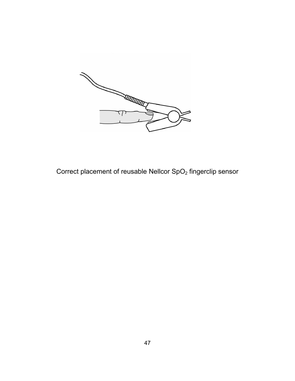 Welch Allyn Atlas Monitor - User Manual User Manual | Page 59 / 108