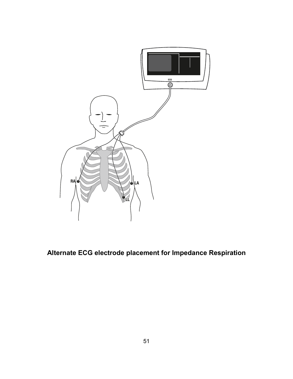 Welch Allyn Atlas Monitor - User Manual User Manual | Page 63 / 108
