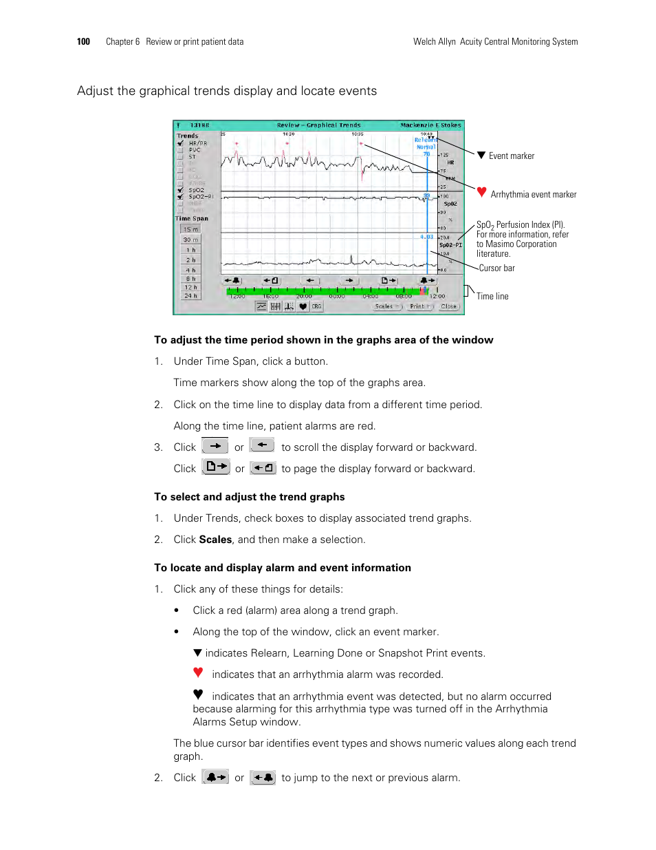 Welch Allyn Acuity and Mobile Acuity LT Central Monitoring Systems - User Manual User Manual | Page 104 / 214