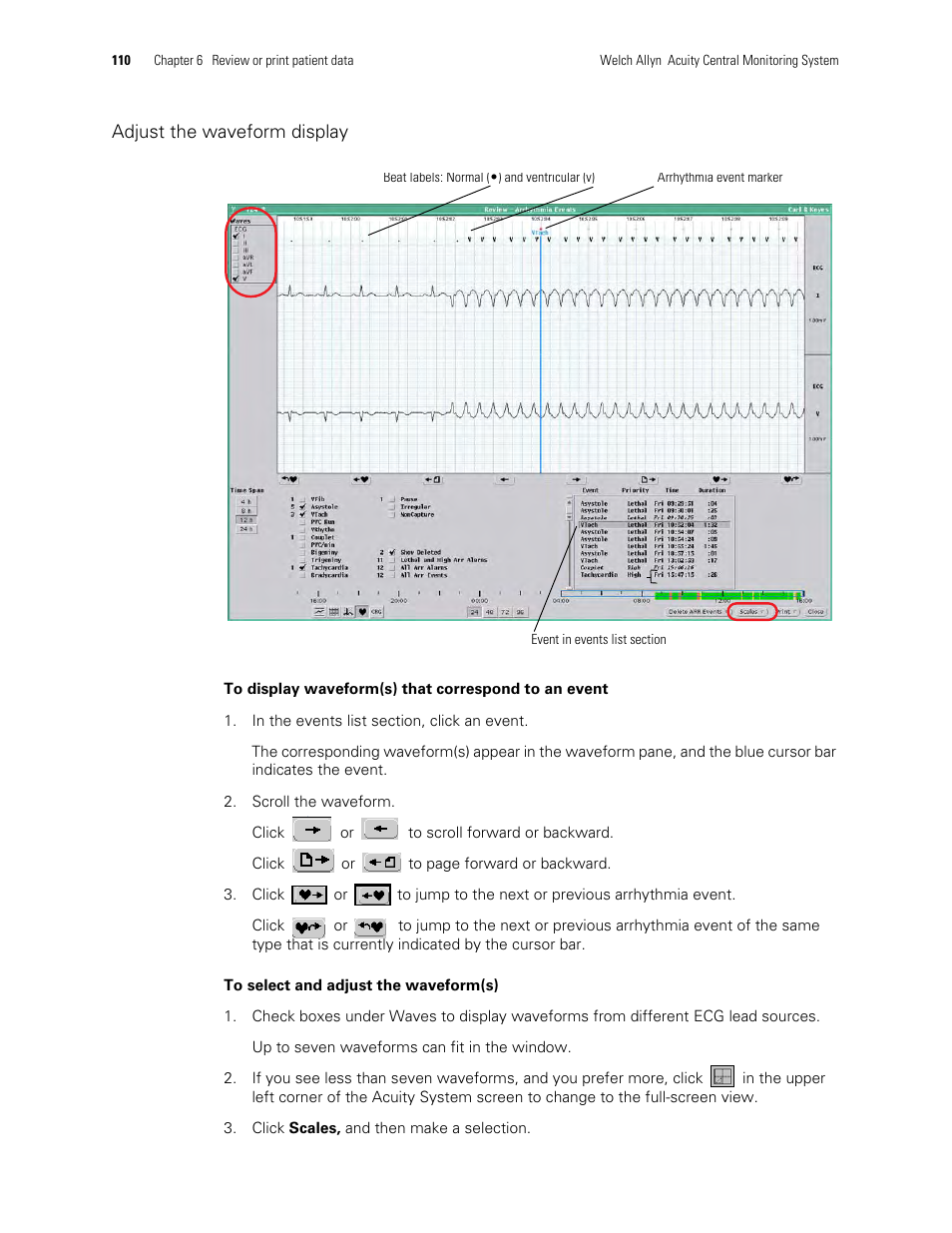 Welch Allyn Acuity and Mobile Acuity LT Central Monitoring Systems - User Manual User Manual | Page 114 / 214