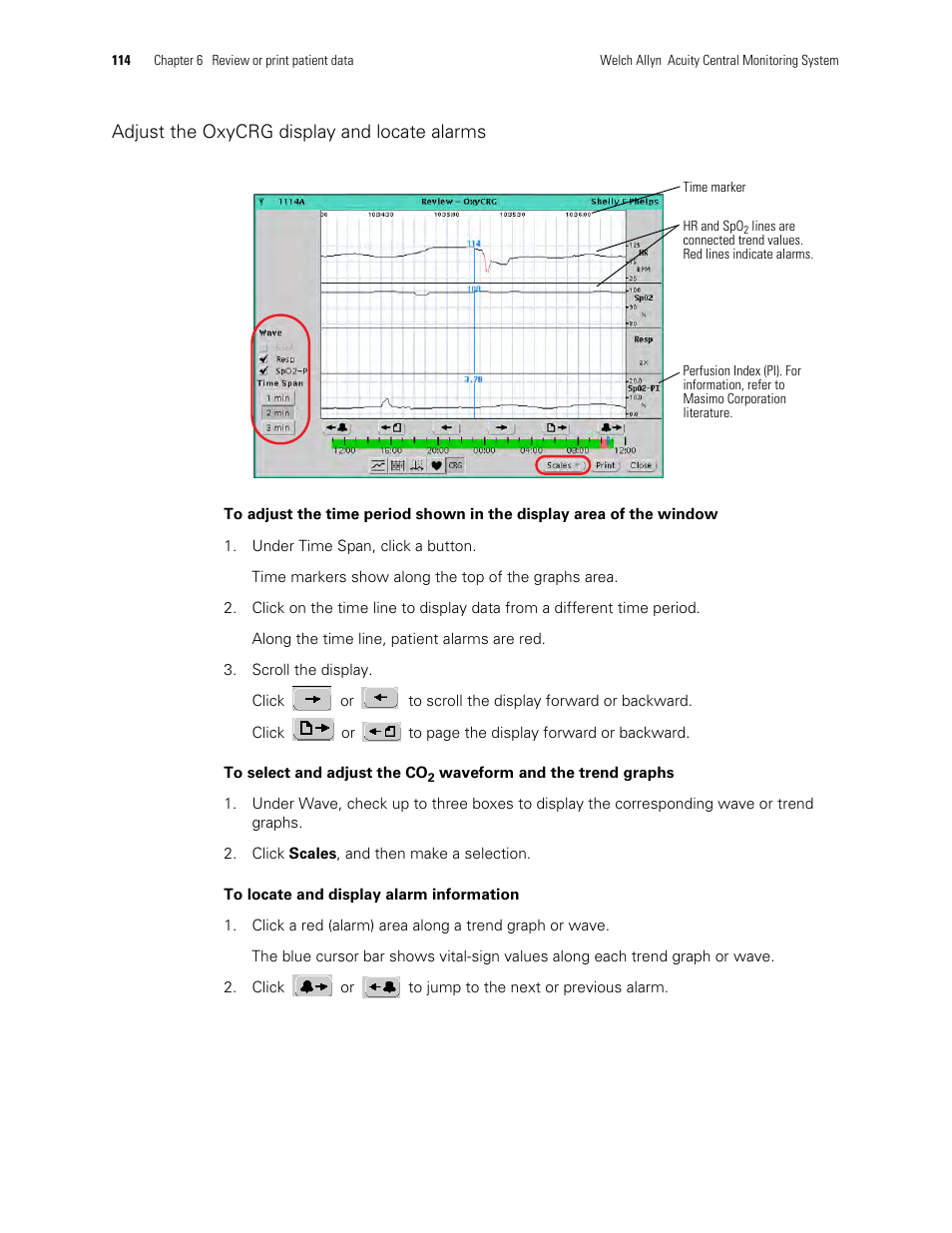 Adjust the oxycrg display and locate alarms | Welch Allyn Acuity and Mobile Acuity LT Central Monitoring Systems - User Manual User Manual | Page 118 / 214