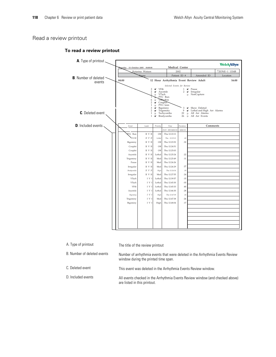 Read a review printout | Welch Allyn Acuity and Mobile Acuity LT Central Monitoring Systems - User Manual User Manual | Page 122 / 214