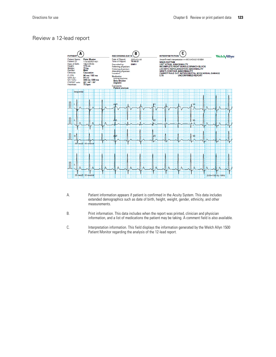 Review a 12-lead report | Welch Allyn Acuity and Mobile Acuity LT Central Monitoring Systems - User Manual User Manual | Page 127 / 214
