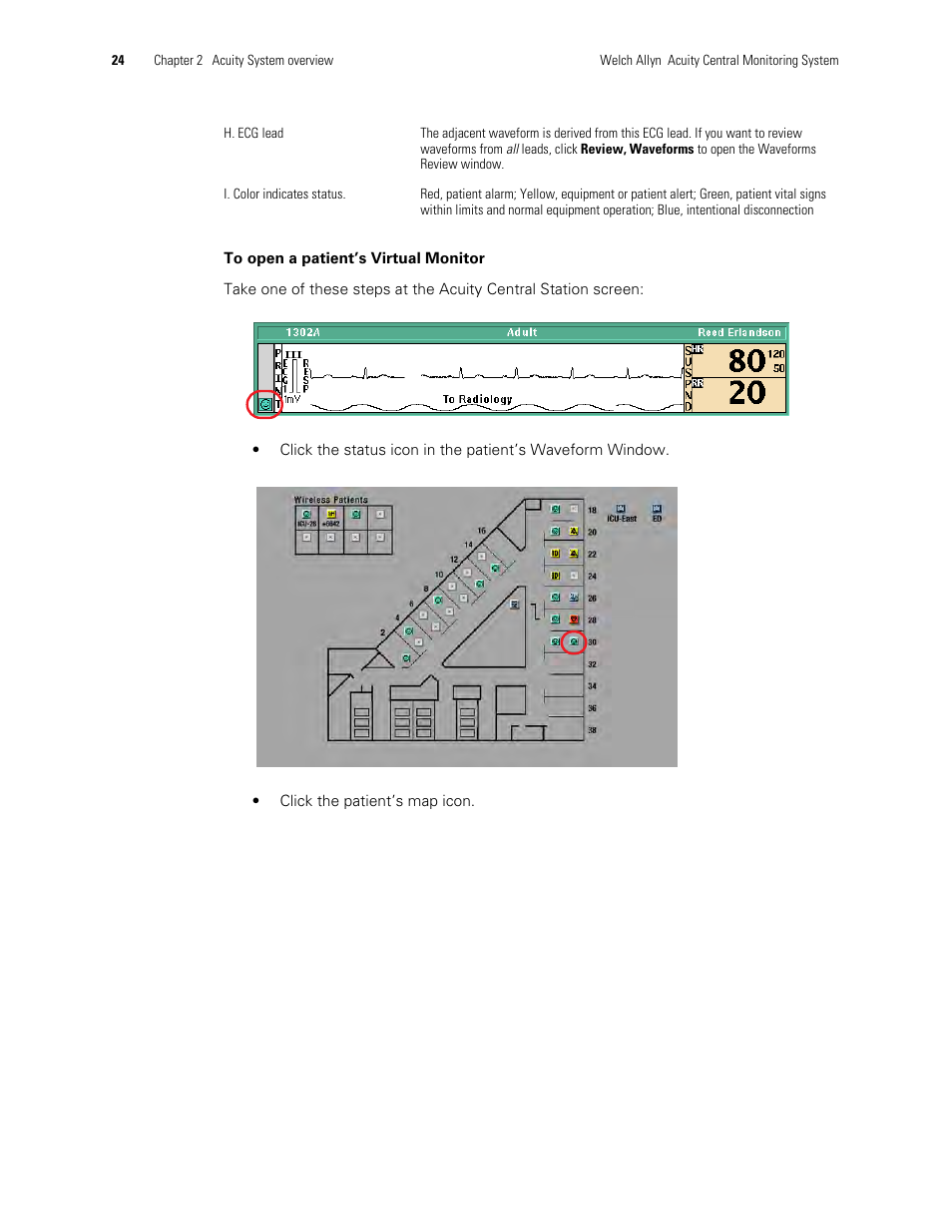 Welch Allyn Acuity and Mobile Acuity LT Central Monitoring Systems - User Manual User Manual | Page 28 / 214